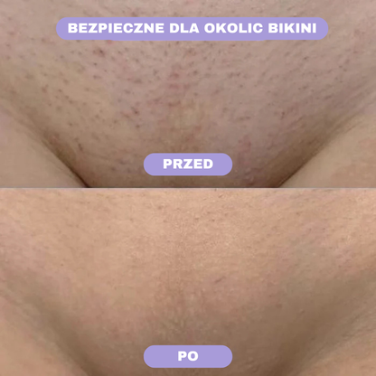 Krystaliczny Depilator Glissa